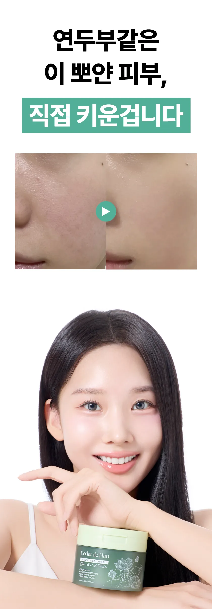 로터스 트러블 케어 패드 미니 상세 이미지 2