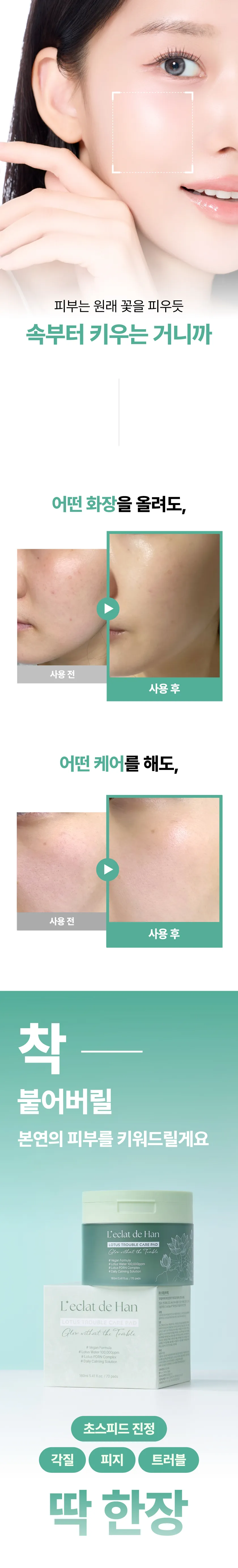 로터스 트러블 케어 패드 미니 상세 이미지 4