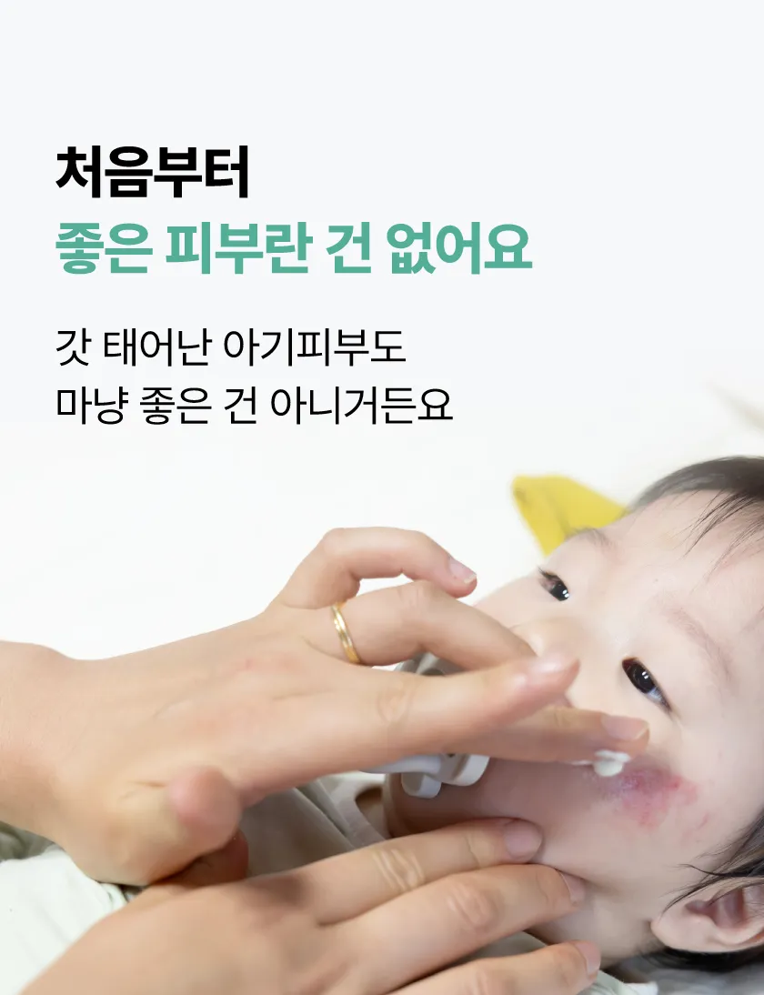 로터스 트러블 케어 패드 미니 상세 이미지 6