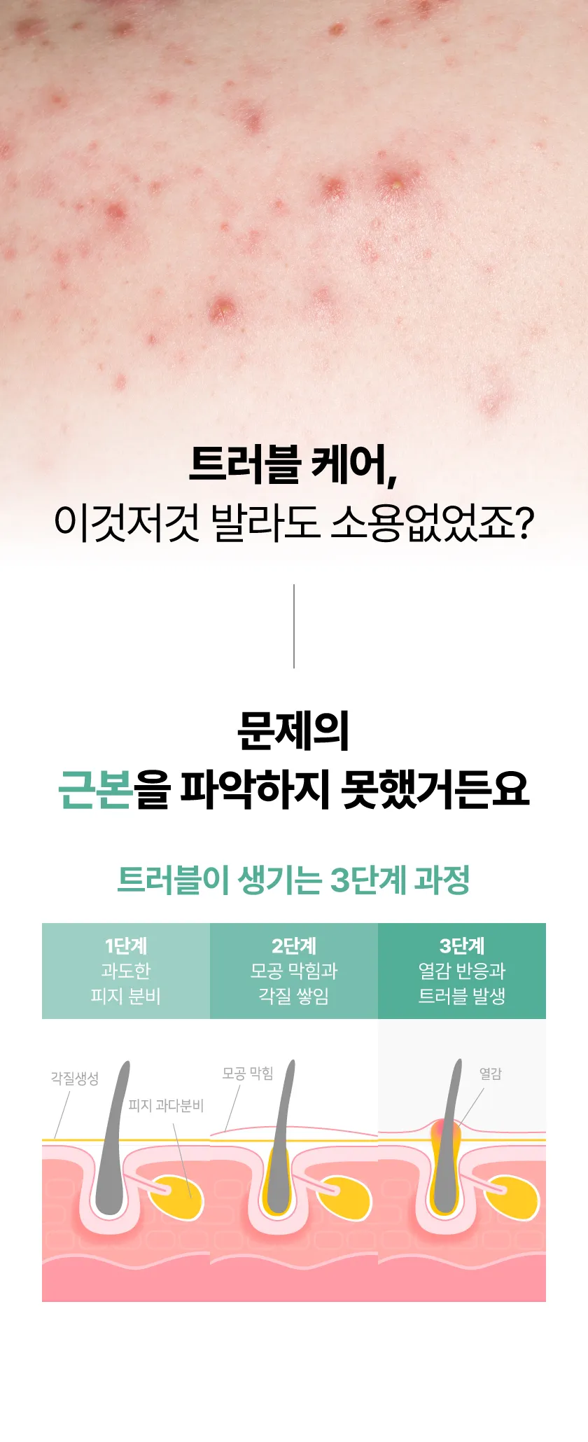 로터스 트러블 케어 패드 미니 상세 이미지 33